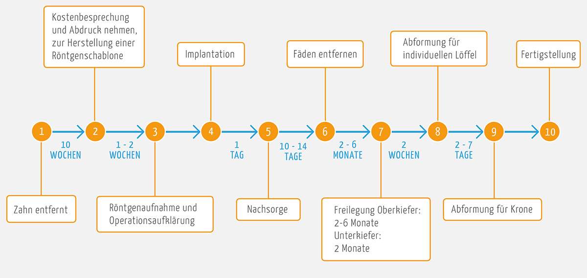 Zeitlicher Ablauf einer Implantation Zahnimplantate